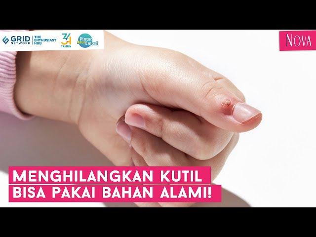 Bahan Alami untuk Menghilangkan Kutil, Mudah dan Ampuh!