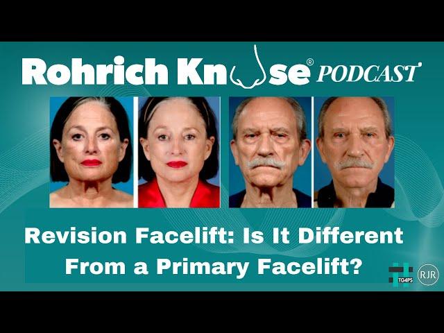 Why Revision Facelift Surgery is so Different and Challenging