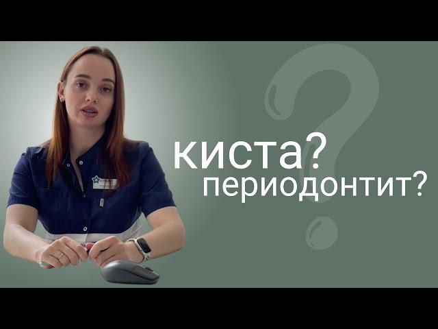 Киста зуба или периодонтит? Причины, обзор снимков, этапы лечения зубов от кисты