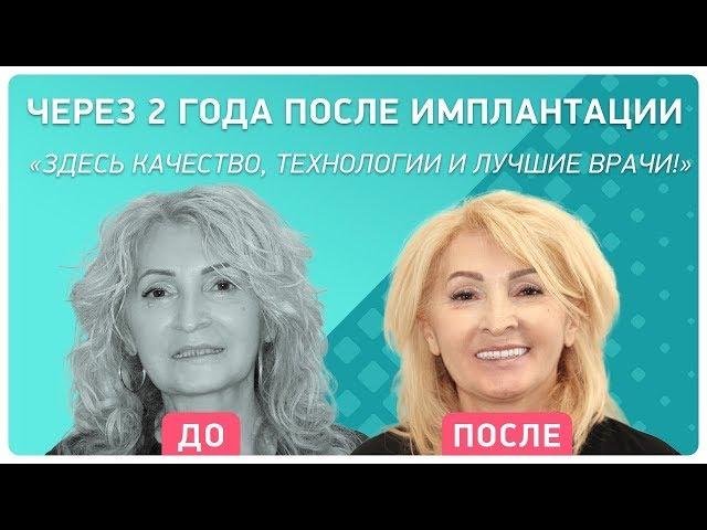 Отзыв через 2 года после установки имплантов в Smile at Once