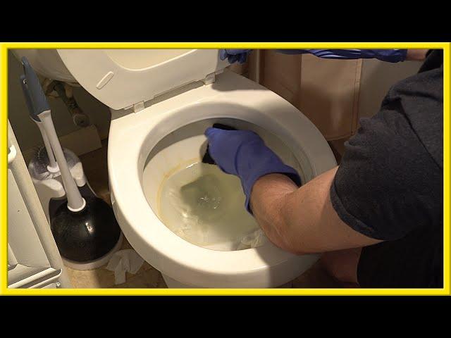 How to Remove Hard Water Stains from Your Toilet Bowl (Easy Method)