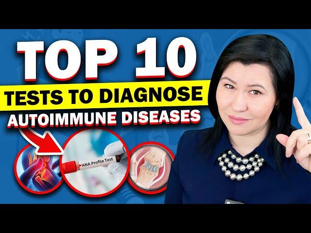 How to Diagnose an Autoimmune Disease? Use these 10 laboratory tests