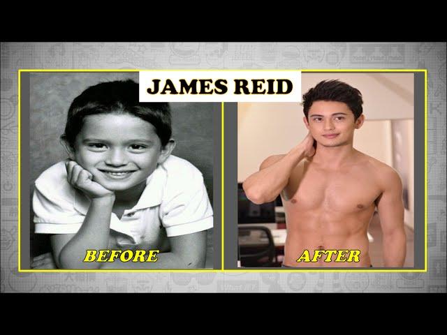 Pinoy Celebrities Before and After