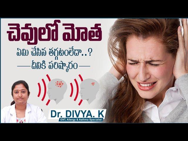 చెవులో మోత || Reason For Sound in Ear in Telugu || Tinnitus Treatment || Sankhya Hospitals