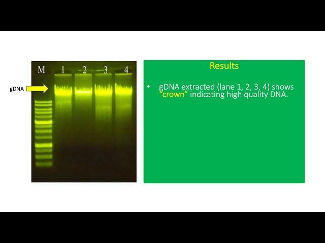 How To Interpret Extracted DNA Result In Agarose Gel 