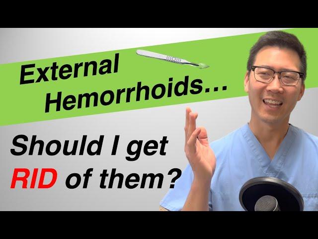 External hemorrhoid treatment: Should I REMOVE or LEAVE them?