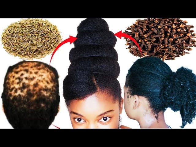 Your hair may become too thick to handle in JUST 2 WEEKS of using this hair tea #howto #diy