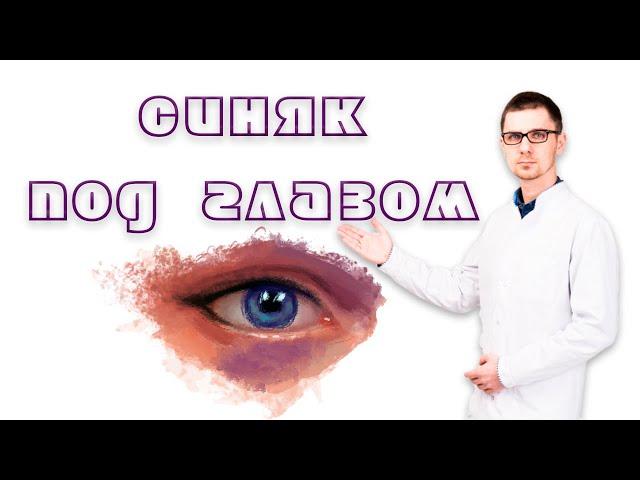 Синяк под глазом от удара