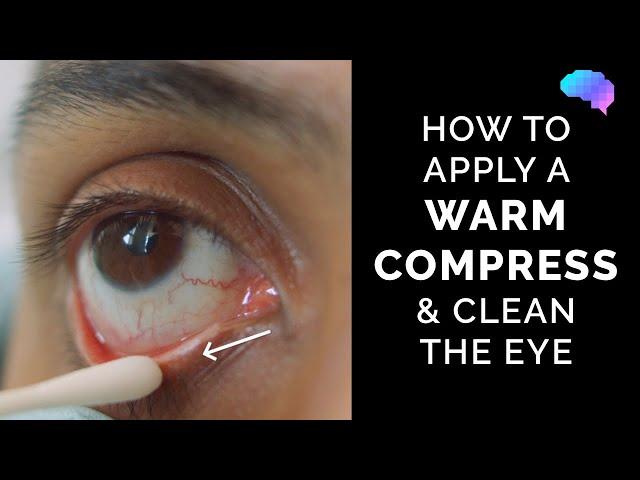 How to Apply a Warm Compress & Clean the Eye | Eye First Aid | OSCE Guide | UKMLA | CPSA | PLAB 2