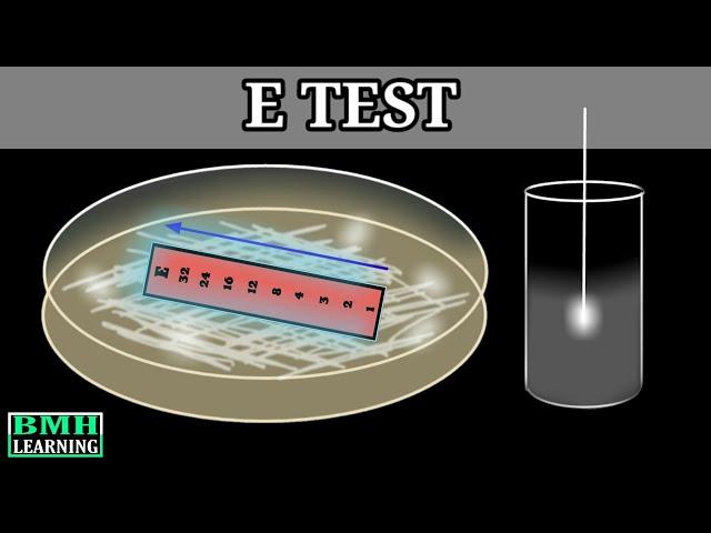 E Test |  E Test For Antibiotic Susceptibility | MIC Determination By E Test | Epsilometer Test |