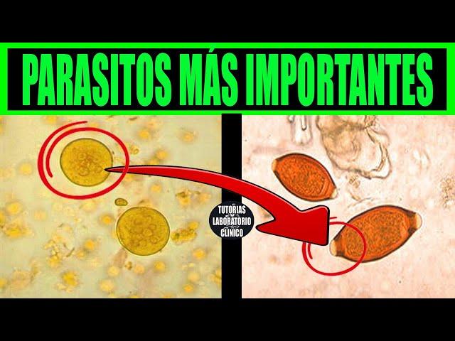 12 PARÁSITOS increíbles que deberías Conocer para Aprobar PARASITOLOGÍA