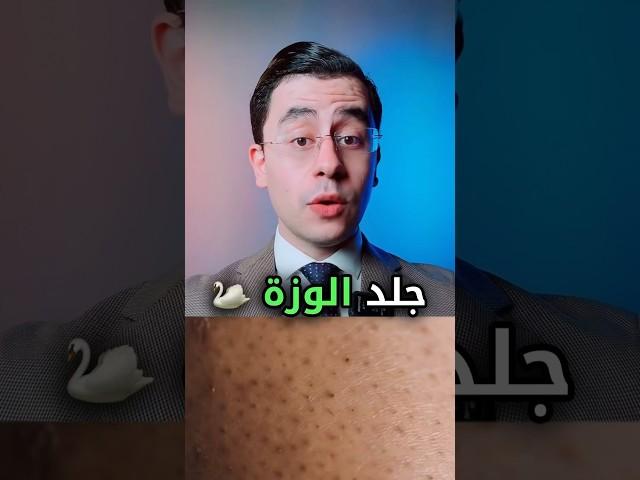 افضل وصفة لعلاج جلد الوزة  وتحدي