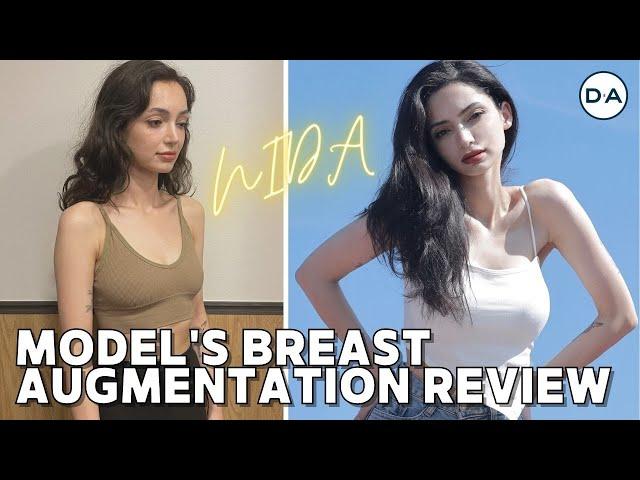 [Plastic Surgery Korea] Breast Augmentation Review From Model Nida