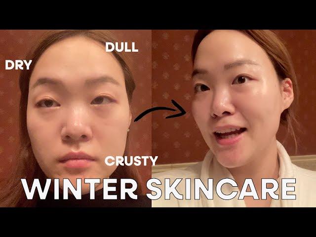 Skincare that's saving my ass lol | Winter Skincare