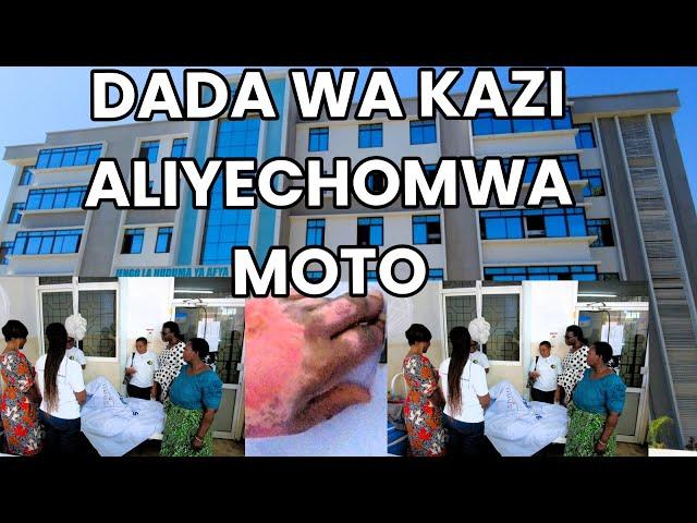 BMG TV: Dada wa kazi aliyechomwa moto aendelea kupata nafuu