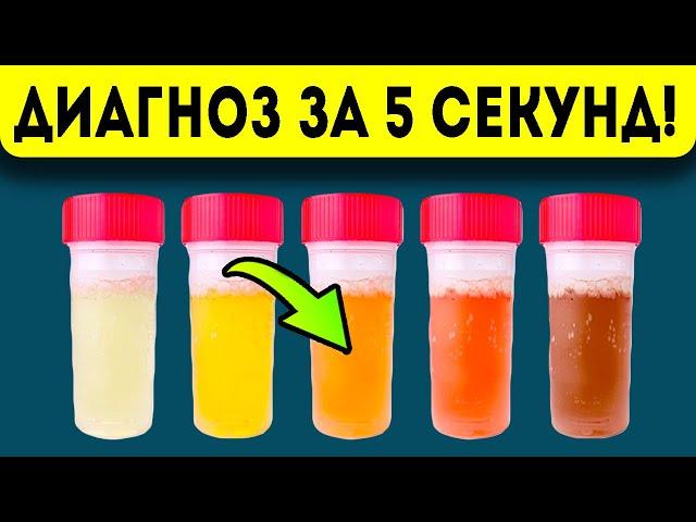 Утренняя моча подскажет, какой из органов выходит из строя: цвет, запах и …