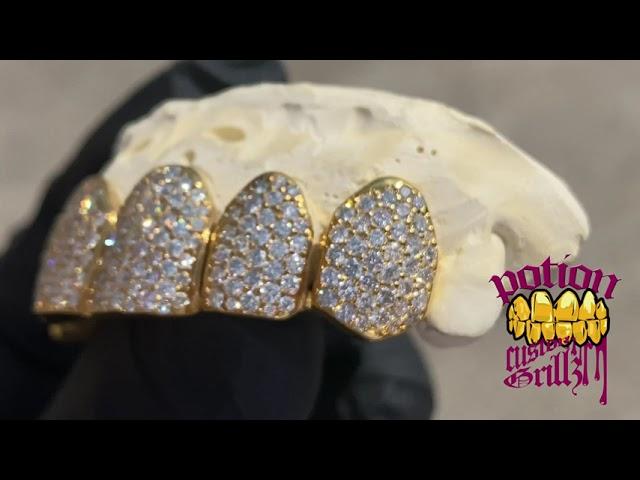 Si1 Diamond Grillz Top Yellow Gold