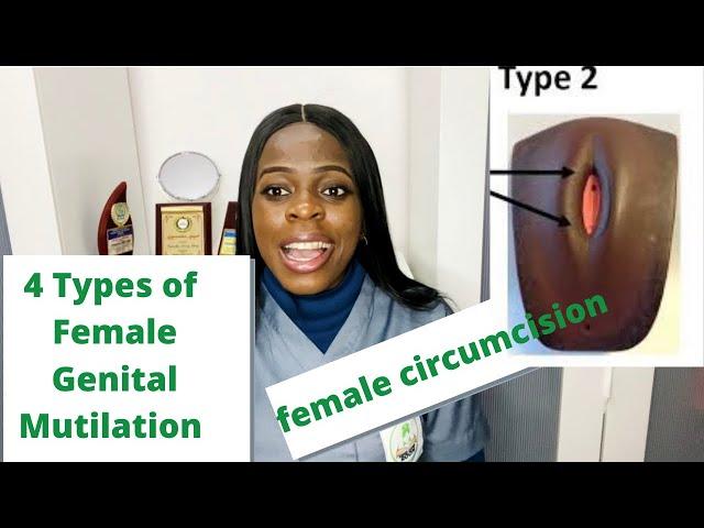 4 types of female genital mutilation you should know