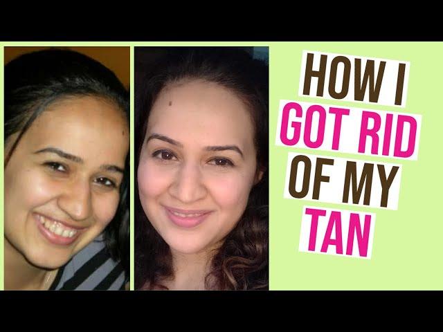 How I got rid of my Tan ? - Dr.Manjot, MD Dermatologist