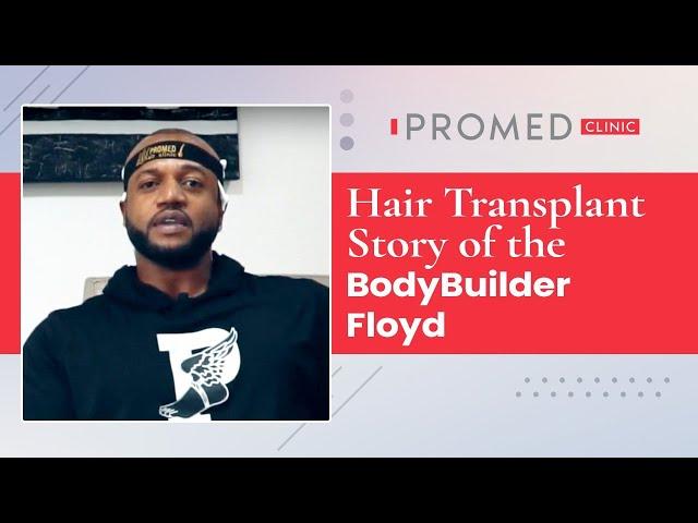 Hair Transplant Story Of The Bodybuilder Floyd in #Promed