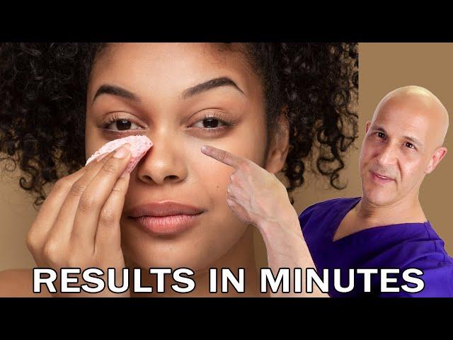 2 Home Ingredients:  Fade Dark Circles and Under-Eye Bags (Results in Minutes)  Dr. Mandell