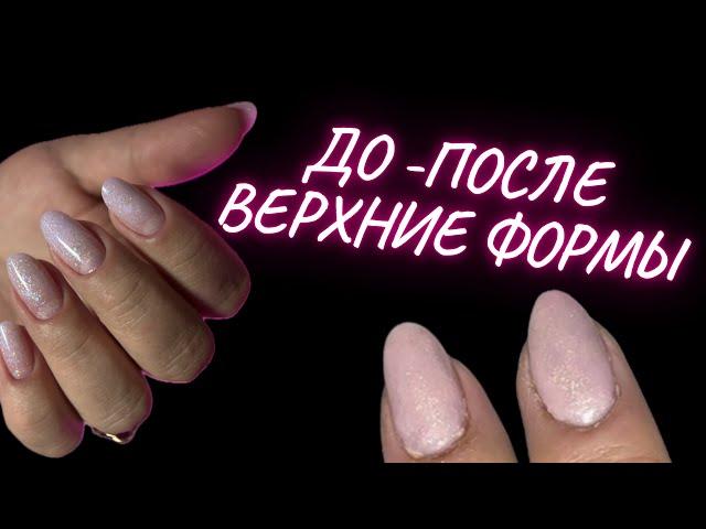 ВЕРХНИЕ ФОРМЫ БЕЗ ЗАТЕКОВ | ПРОПИЛЫ В МАНИКЮРЕ | КОРРЕКЦИЯ НОГТЕЙ