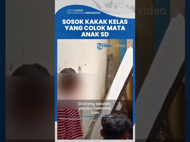 Sosok Kakak Kelas yang Mencolok Mata Bocah SD Hingga Buta, Ternyata Pelaku Sudah Sering Memalak