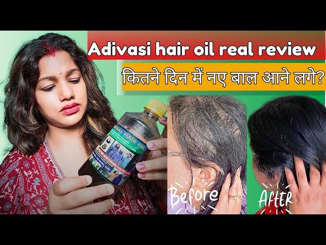 100% original ADIVASI Hair Oil  Honest review with LIVE RESUL। मेरे बालों का क्या से क्या हाल बना