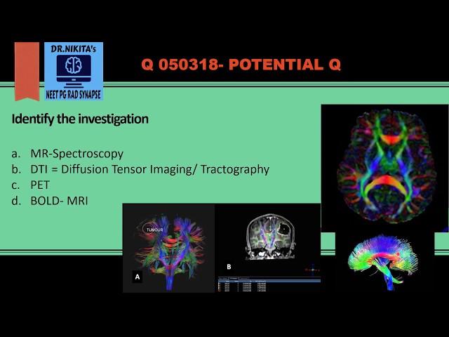 Diffusion tensor imaging (DTI) / TRACTOGRAPHY