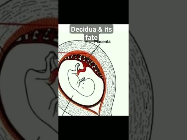 Decidua and its fate | Decidua basalis | decidua parietalis | decidua capsularis | #logicmedico