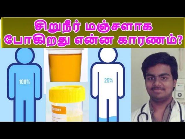 சிறுநீர் ஏன் மஞ்சளாக போனால் Kidneyக்கு ஆபத்தா?தீர்வு என்ன? Why Urine appears Yellow? Mightymedicoz