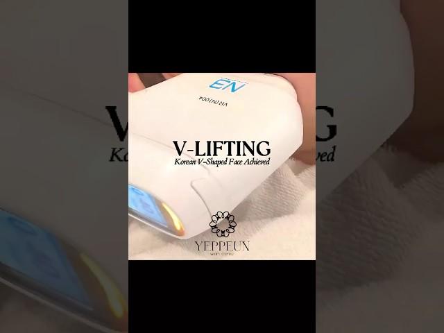 V-LIFTING | DUBAI CLINIC | SKIN CLINIC IN DUBAI #dubai #dubaibeauty #vlift #lifting #koreanskincare