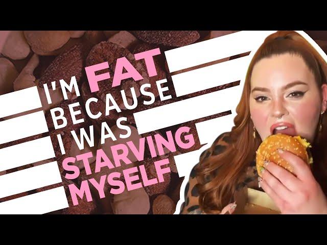 Plus-Size Model Claims She's Anorexic