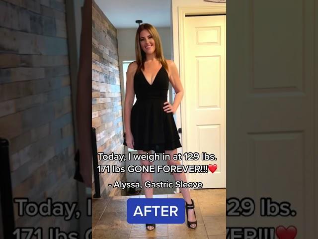 171 lbs Gone Forever!! | My Weight Loss Surgery Journey