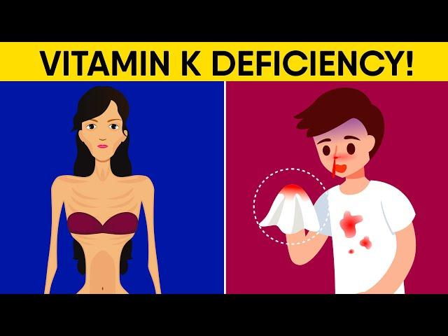 12 Hidden Signs You Have Vitamin K Deficiency