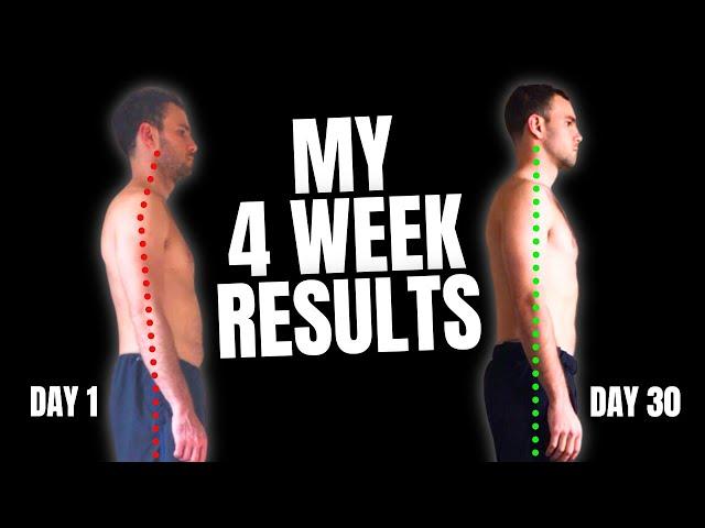 How long it took to fix my posture and 3 exercises I used