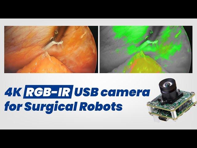 8MP RGB-IR USB camera for Surgical Robots | Simultaneous RGB & IR Streaming | e-con Systems