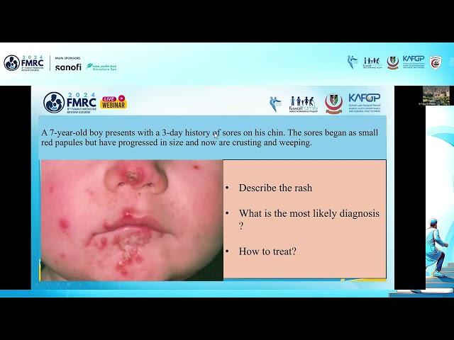 Common Dermatology in Primary Care - Dr. Asma Al Shidhani