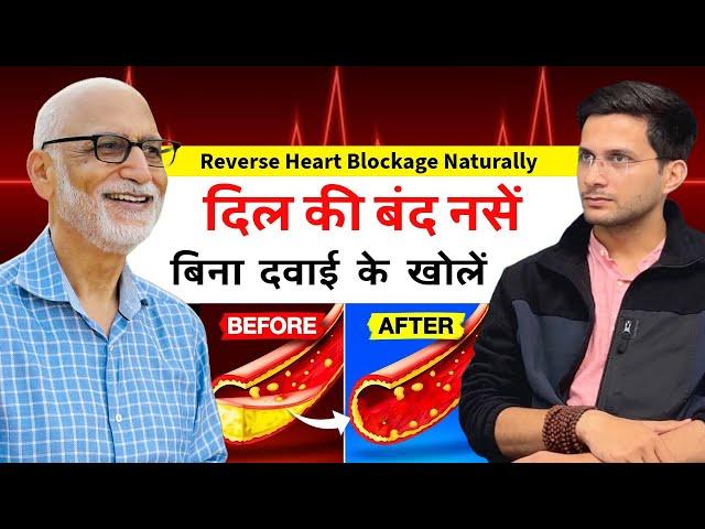 Reverse Heart Blockage Naturally Ft. Dr. Susheel Sharma | Unclog Arteries | Himanshu Bhatt