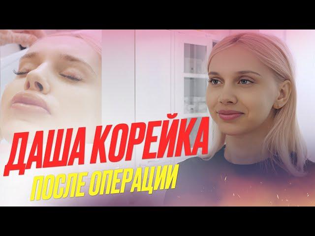 ДАША КОРЕЙКА | ПОСЛЕ ОПЕРАЦИИ | УВЕЛИЧЕНИЕ ГУБ!