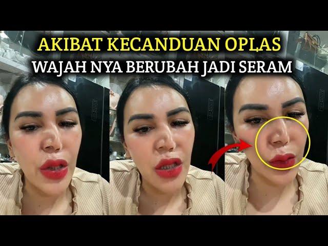 Ratu Entok Sok ! Hidung nya Tiba-Tiba Bengkok Setelah Bangun Tidur