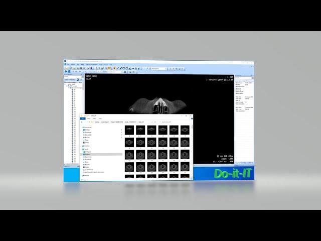 How to Export DICOM files to JPG with MicroDicom
