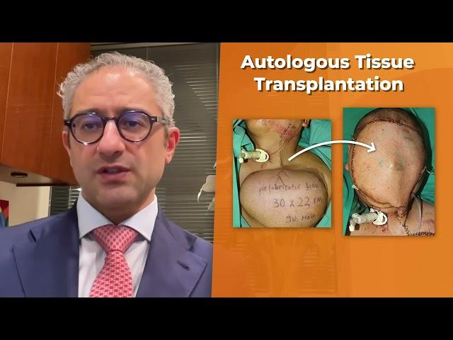 New Technology Improves Total Face Reconstruction by Amir Dorafshar, MD