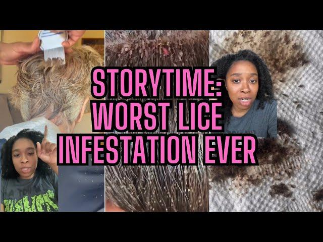 Storytime: Worst Lice Infestation Ever l Neglectful Parents l CPS should’ve been called #explore