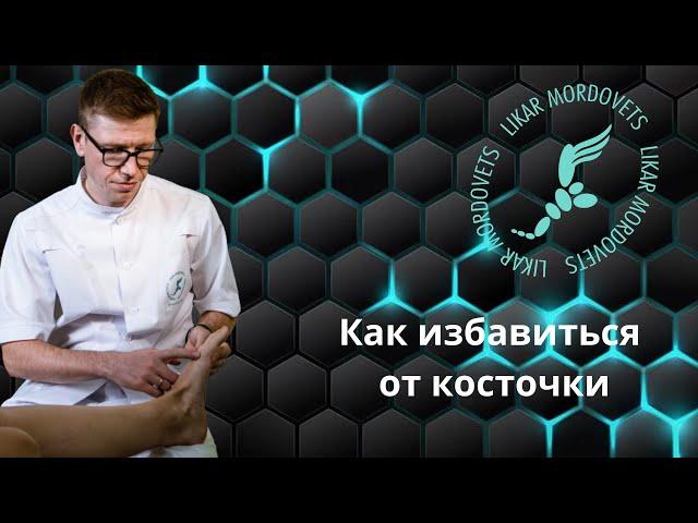 как избавиться от косточки на стопе