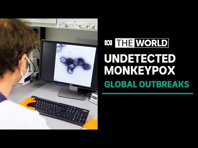 Disease experts say data indicates at least two separate Monkeypox outbreaks underway | The World