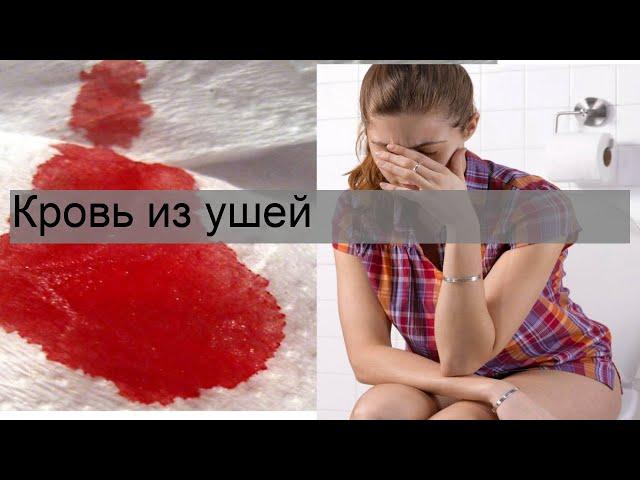 Кровь из ушей