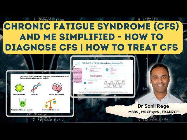 Chronic Fatigue Syndrome and ME Simplified - How to Diagnose and Treat CFS | A Psychiatrist Explains