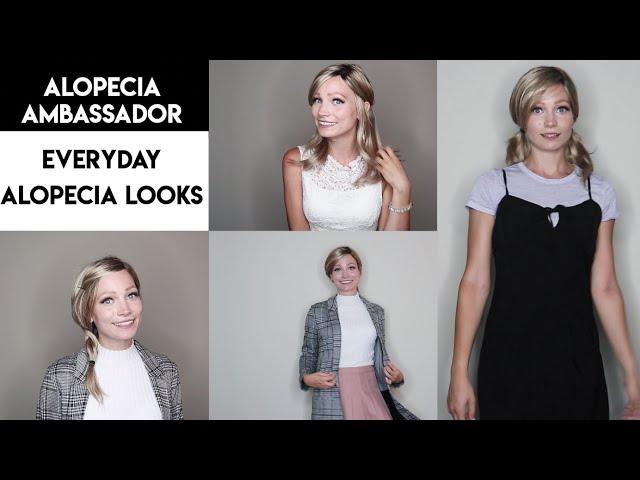 Everyday Alopecia Wig & Outfit Styling with Our Alopecia Ambassador Abby Andrew