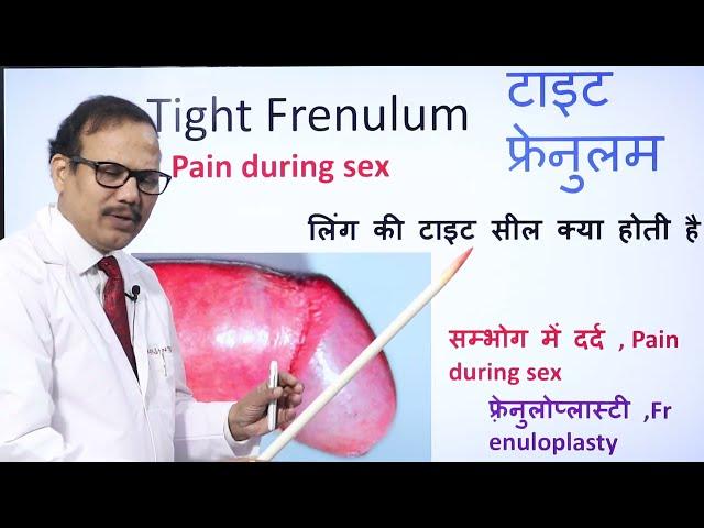 Tight frenulum | pain in sex | frenuloplasty | Dr.(Prof)Santosh Kumar PGI